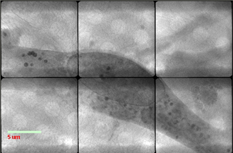 Researchers from VHIR and ICMAB-CSIC obtain first images of human endothelial stem cells at ALBA Synchrotron
